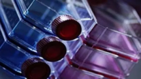 Mesoblast Limited's (ASX:MSB)