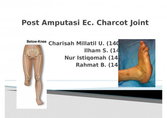 picture1_Post Amputasi Ec Charcot Joint