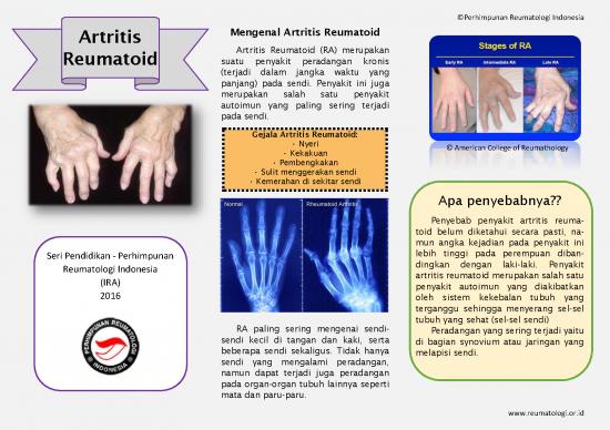 picture1_Rheumatoid Arthritis
