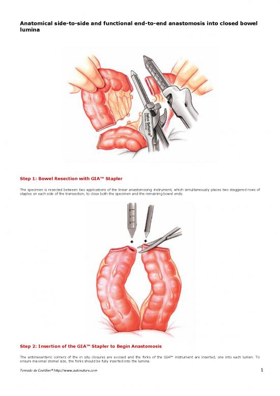 picture_Anastomosis Intestinal