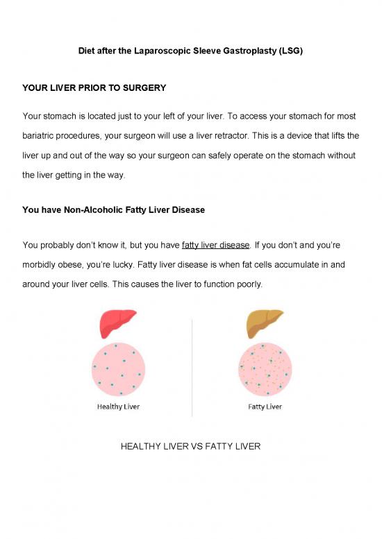 picture_Diet After Gastric Sleeve Surgery Pdf 140644 | Diet After Lsg
