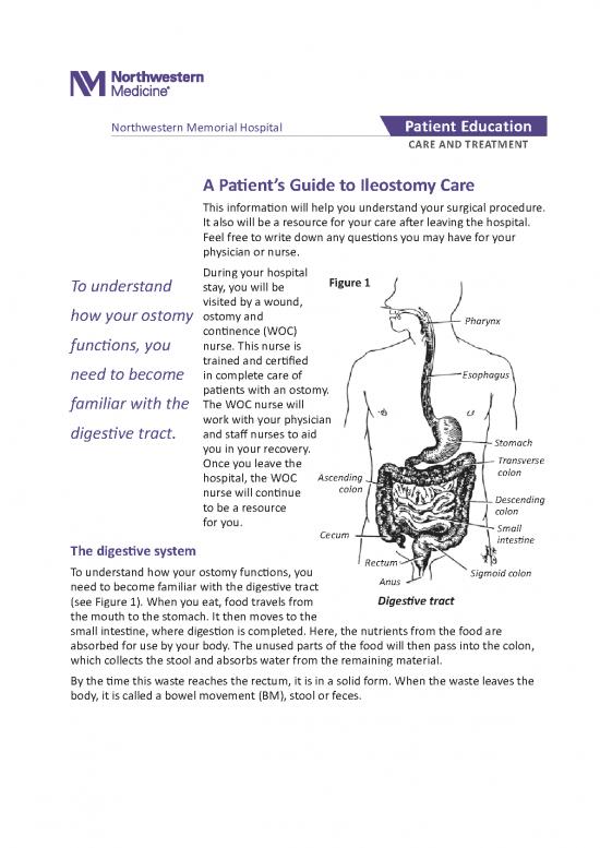 picture1_Certified Pdf 141393 | Northwestern Medicine A Patients Guide To Ileostomy Care