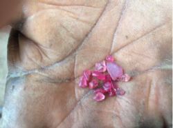 High quality rubies from secondary ruby deposit being mined by artisanals on license 8245L