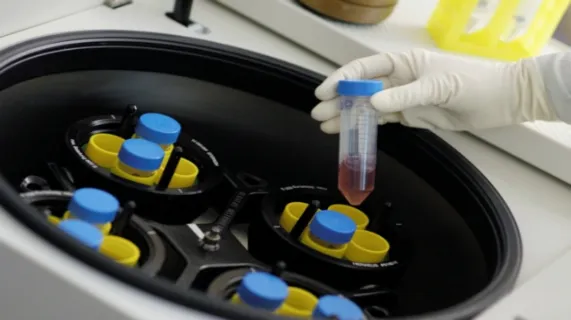 Mesoblast Limited (ASX:MSB)