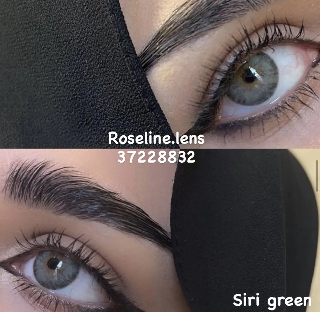 عدسة ١