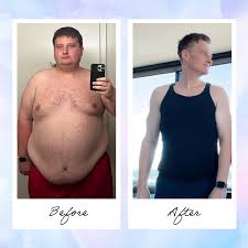 Dónde comprar Naltrexona-bupropión (Contrave) en España online sin receta.