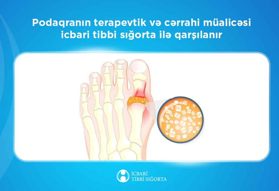 Podaqranın müayinə və müalicəsi icbari tibbi sığorta hesabına aparılır
