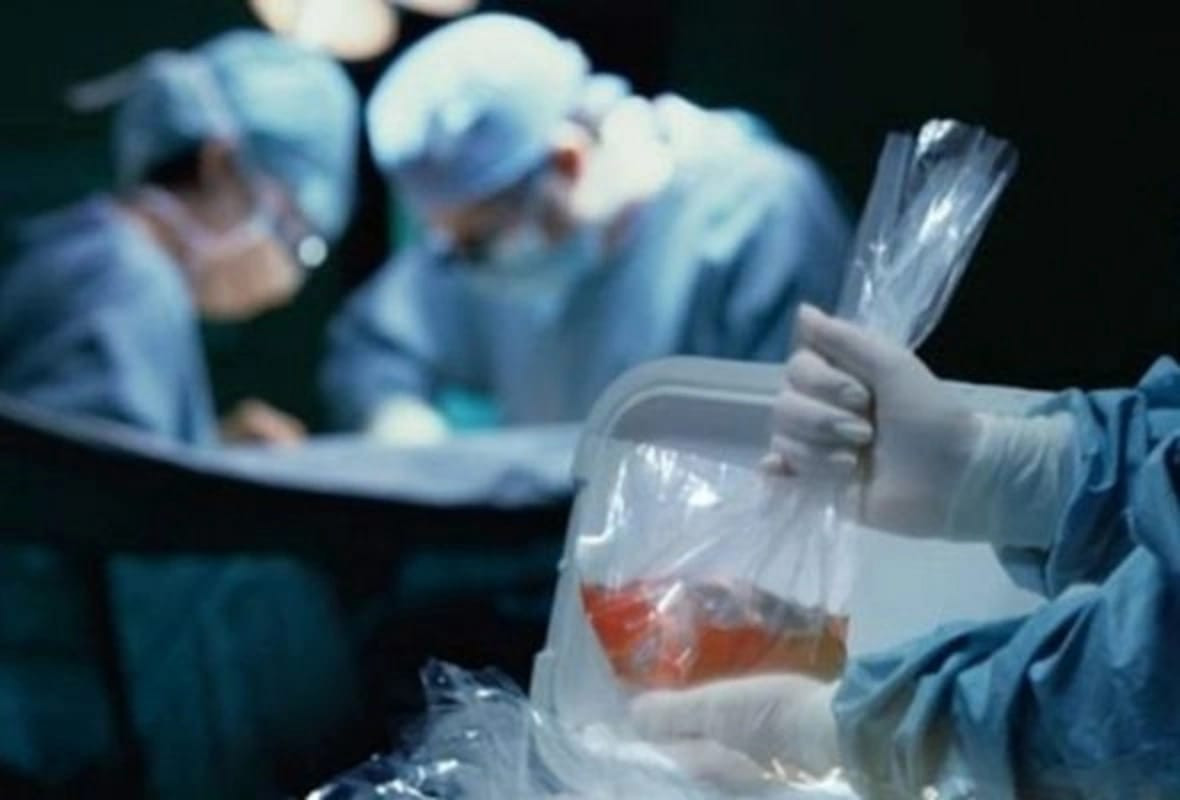 Azərbaycanda orqan transplantasiyası: Mövcud vəziyyət və problemlər