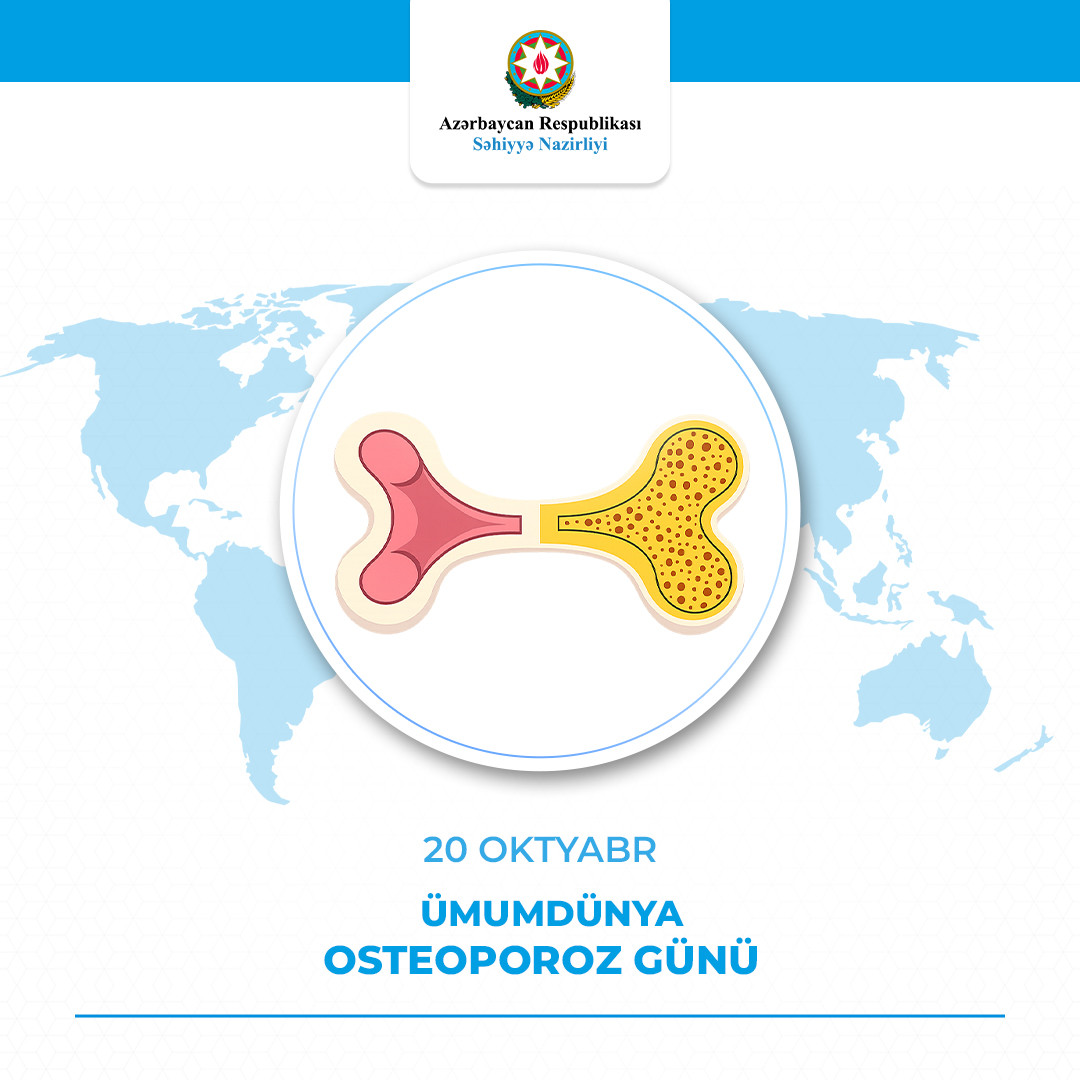 Səhiyyə Nazirliyi: Sümük sağlamlığını qoruma tədbirləri uşaqlıq və gənclik dövründən başlanmalıdır