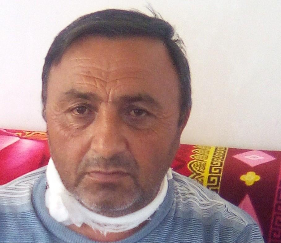 "Hörmətli nazir, məqsədiniz köməksiz&nbsp;dializ xəstəsini məhv etməkdirmi?" - Xəstə fəryad edir, nazirlik susur