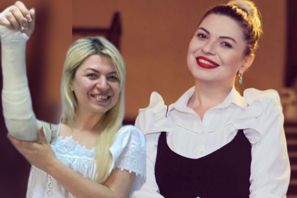 Aktrisa Zümrüd Qasımovanın çəkilişdə qolu sındı - FOTO
