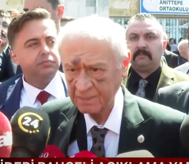 Qolu sınan MHP sədrinin indi də üz-gözü qançır olub - FOTOLAR