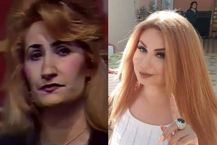 Könül Kərimova keçmişdə və indi: "Bədənində plastik əməliyyat olmayıb" - FOTO