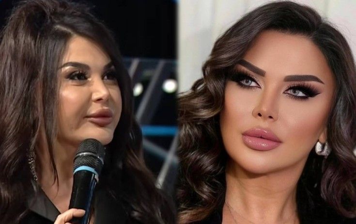 Müğənni Təranə Qumralın qızı: "Kosmetoloq üzünə&nbsp;botoks vurub, sifətim donmağa başlayıb"