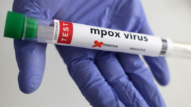 Qanada 34 nəfərdə təhlükəli virus aşkarlanıb