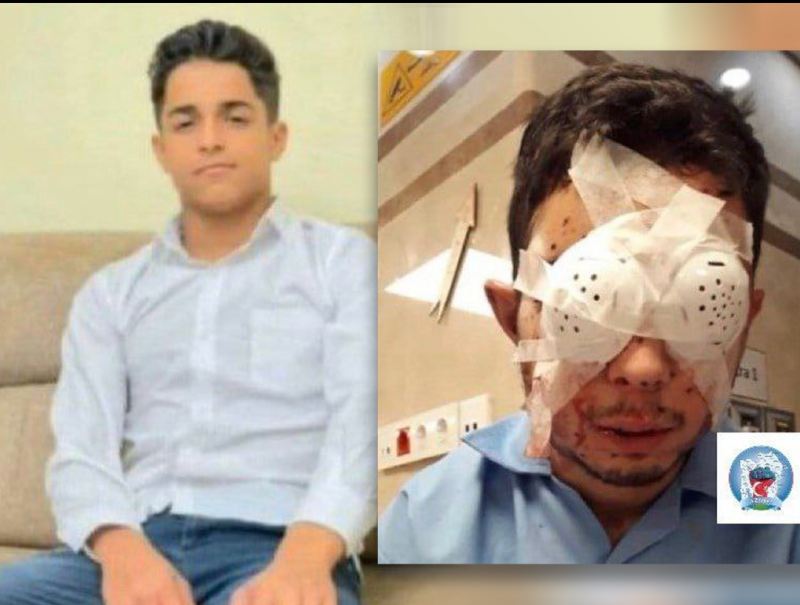 Molla rejiminin kor etdiyi güneyli oğlan İNTİHAR EDİB - FOTO