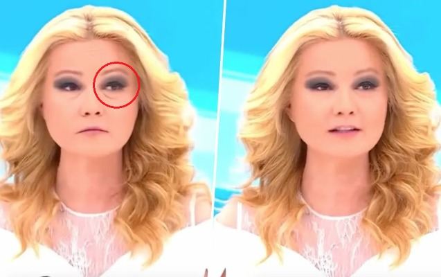 Canlı efirdə üzündəki filtr sürüşdü, reallıq ortaya çıxdı - Video