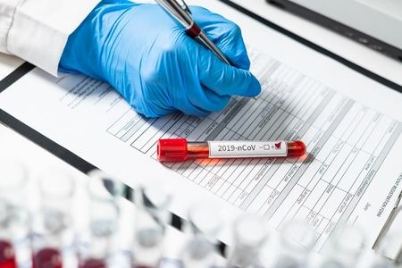 Azərbaycanda daha 53 nəfər koronavirusa yoluxub, 7 nəfər ölüb 
