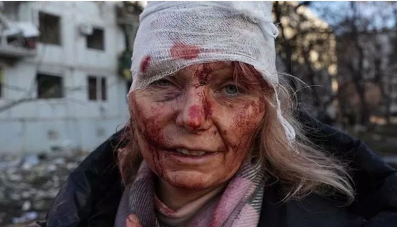 Yaralı fotosu ilə müharibənin simvoluna çevrildi, indi vəziyyəti belədir: \"3 əməliyyat keçirdim...\"