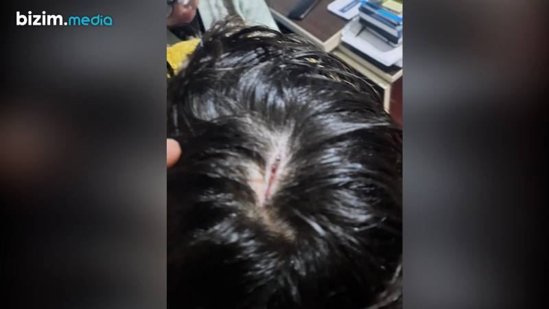 Bakıda doğmalarından işgəncə görən 11 yaşlı qız TAPILDI – FOTOLAR