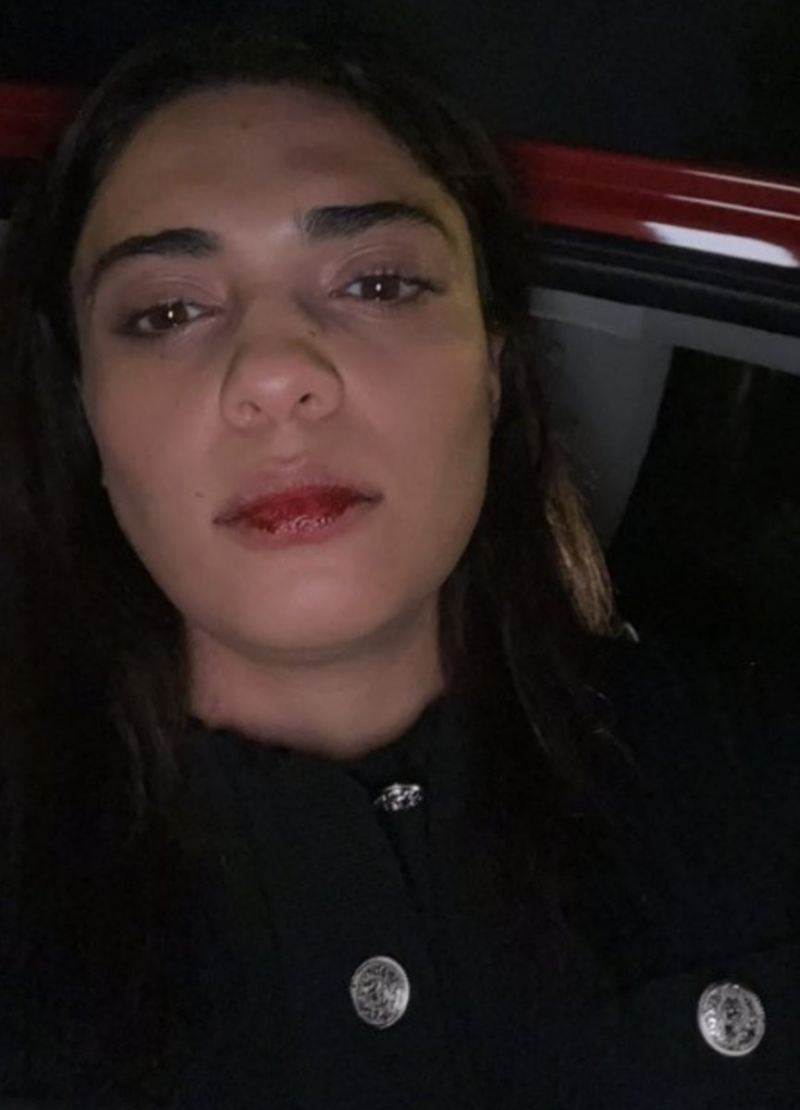 Azərbaycanlı müğənni İstanbulda taksi sürücüsü tərəfindən döyülüb 