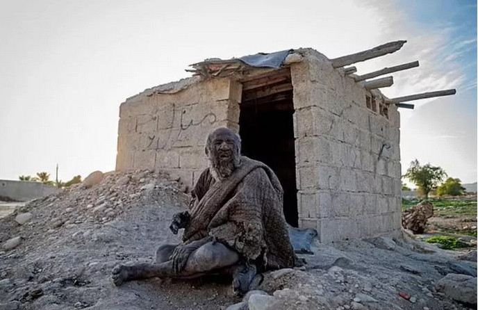 70 il yuyunmayan adam yuyunduqdan sonra ÖLDÜ