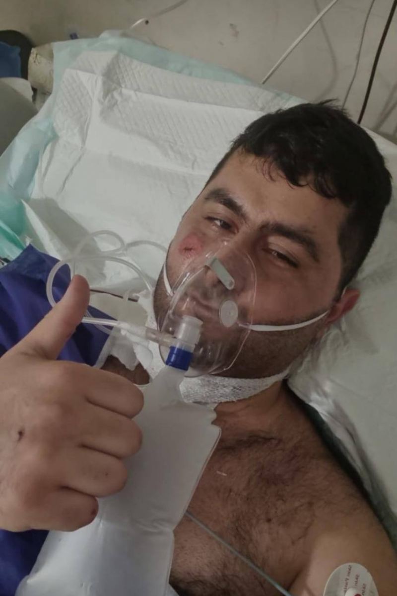Terrorçunu zərərsizləşdirən Vasifin əməliyyatdan sonrakı - Fotosu
