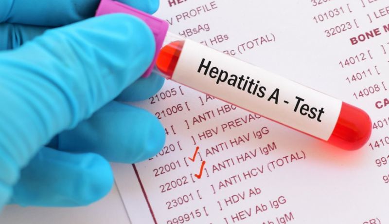 Azərbaycan əhalisinə ÇAĞIRIŞ: hepatit A virusuna qarşı vaksin vurdurun 