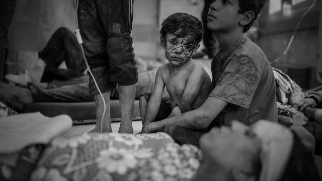 UNICEF: Qəzzada 17 min uşaq... 
