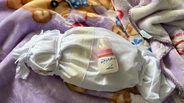UNICEF: Qəzzada körpələr qida çatışmazlığından ölür 