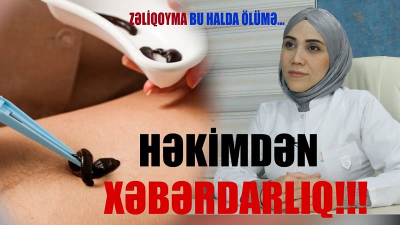Bu təbabət növündən istifadə zamanı diqqətli olun: Anafilaktik şok verə bilər! (VİDEOMÜSAHİBƏ)