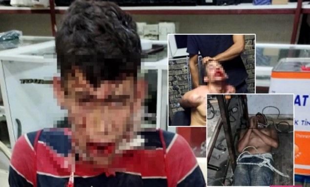 Dişləri sındırıldı, böcək yedirdildi - Antalyada müdirindən pulunu istəyən gəncə ağlasığmaz işgəncə 