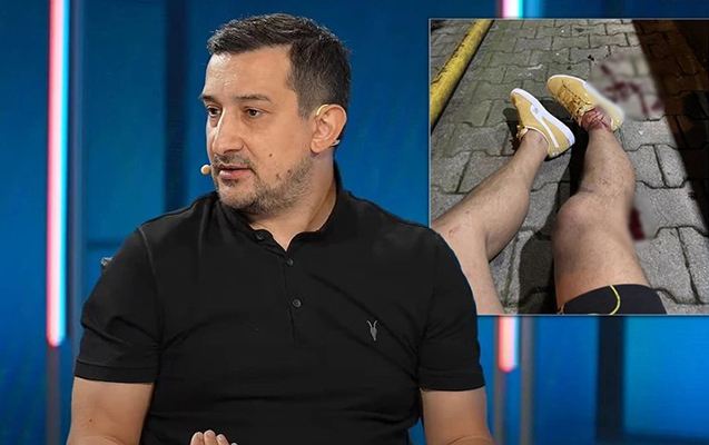 Serhat Akın güllələndi - Foto 