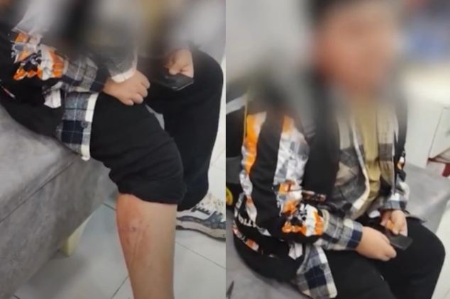 Xırdalanda sahibsiz itlər məktəblinin ayağını DİŞLƏDİLƏR 