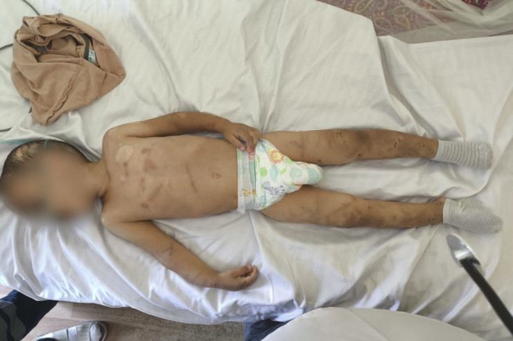 Ağdamda DƏHŞƏT: ata 2 yaşlı uşağını ölümcül döydü 