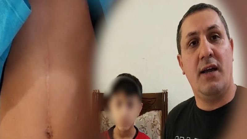 İki orqanı olmayan uşağın əlillik pensiyası kəsildi: Nazirlikdən REAKSİYA - VİDEO