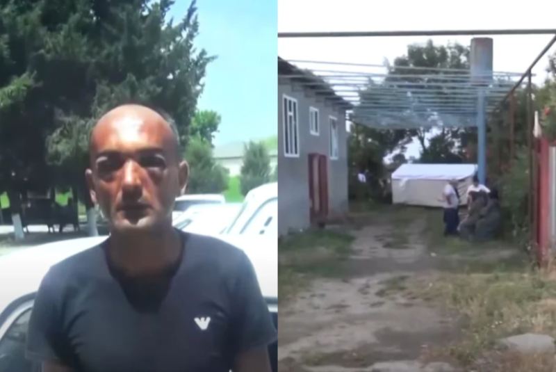 Xəstəxanada ölən şəxs toyda döyülübmüş – TƏFƏRRÜAT 