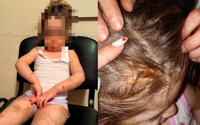 Azyaşlı ona işgəncə verən anasından alındı - FOTO 