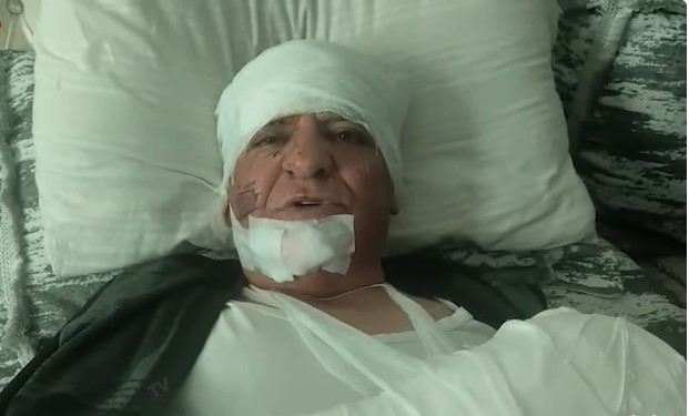 Nərimanovdakı partlayışda yaralanan şəxs danışdı: “Hamısı töküldü üstümə, məni qan aparırdı” - VİDEO