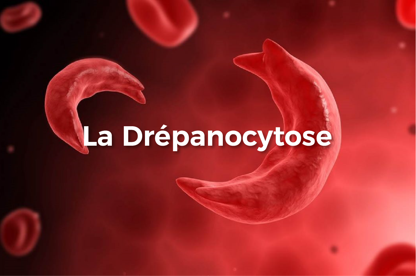 Vivre avec la drépanocytose