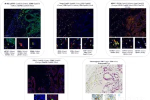 Multiplex immunohistochemistry for tumor microenvironment profiling: ROI-based analytics across tissues