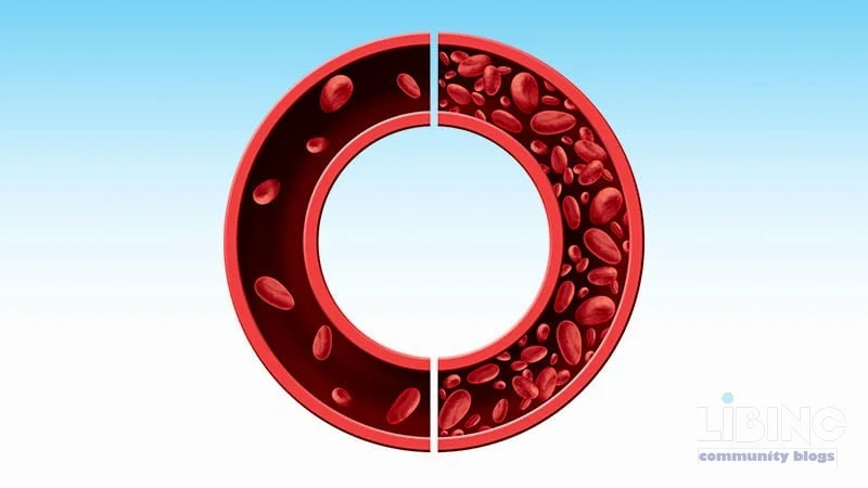Pernicious Anemia Through Time: From Liver Therapy to Lifelong Vitamin B12 Replacement — An Analytical Synthesis