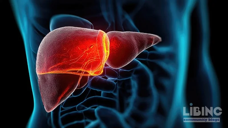 TIPS for ACLF With Fluid Overload: Short-Term Survival and Bridging to Transplant
