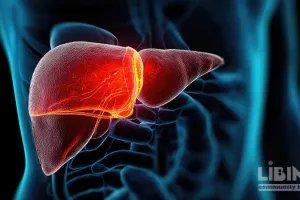 TIPS for ACLF With Fluid Overload: Short-Term Survival and Bridging to Transplant
